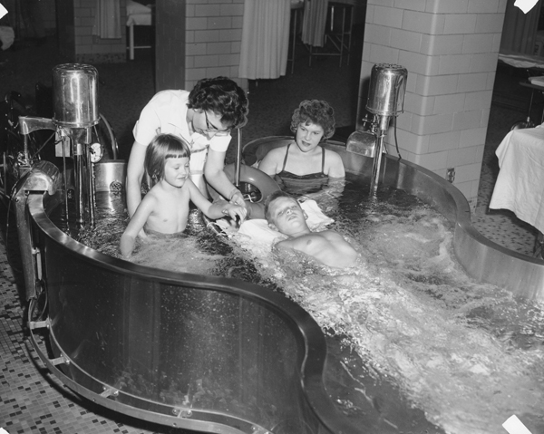 Water Therapy for Polio