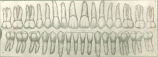Drawings of teeth, The University of Iowa, 1940s?