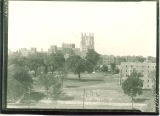 University of Iowa Hospitals and Clinics, the University of Iowa, 1933